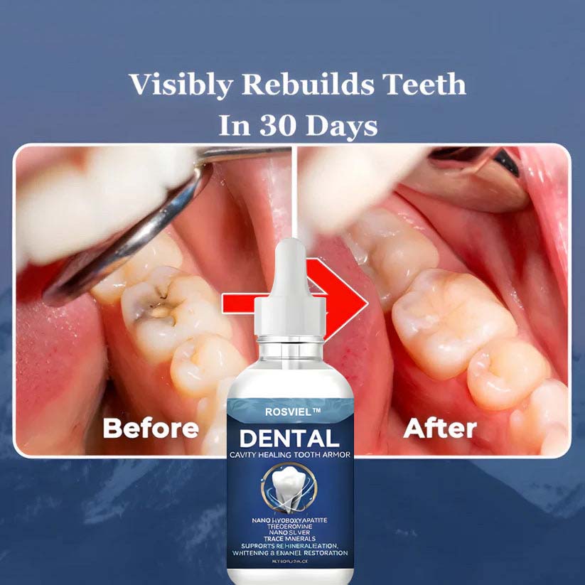 Rosviel™ Advanced Enamel Repair & Whitening Kit (Includes Free LED Mirror)