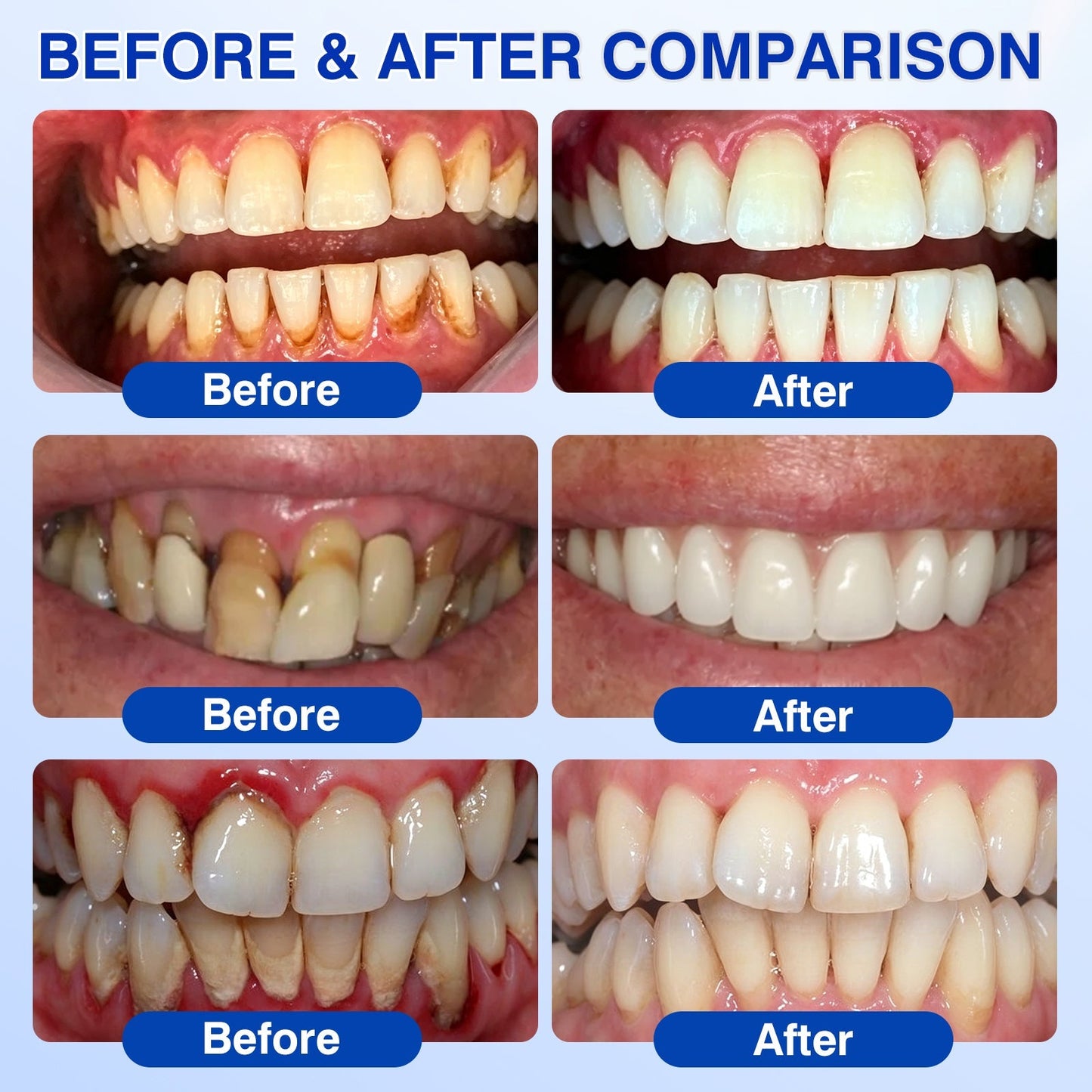 🇨🇦👨‍⚕️🦷🛡️Rosviel® GumRevive Periodontal Repair Gel