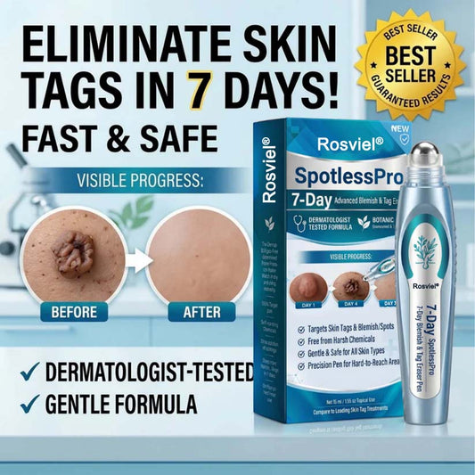 Rosviel® Botanical Spot & Tag Precision RollPen