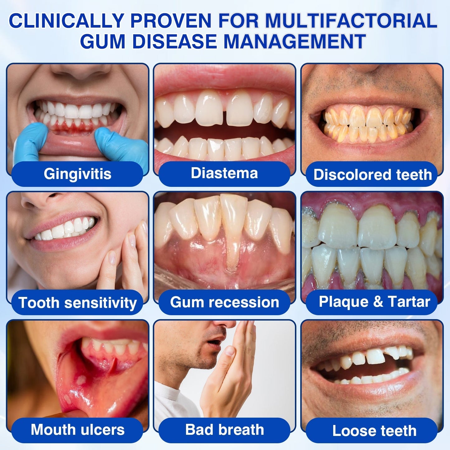 🇨🇦👨‍⚕️🦷🛡️Rosviel® GumRevive Periodontal Repair Gel
