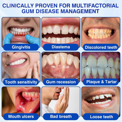 🇨🇦👨‍⚕️🦷🛡️Rosviel® GumRevive Periodontal Repair Gel