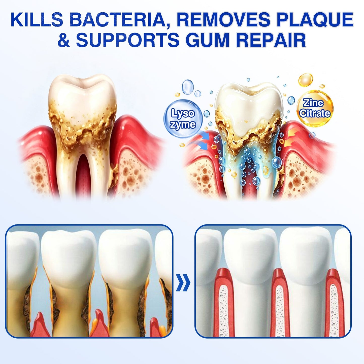 🇨🇦👨‍⚕️🦷🛡️Rosviel® GumRevive Periodontal Repair Gel