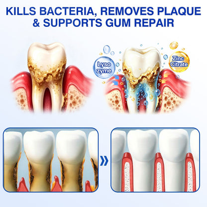 🇨🇦👨‍⚕️🦷🛡️Rosviel® GumRevive Periodontal Repair Gel