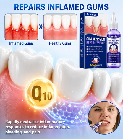 Rosviel® 🦷GumRevive Periodontal Care Gel🍀