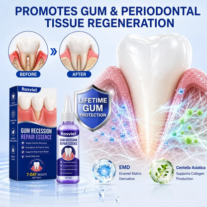 Rosviel® 🦷GumRevive Periodontal Care Gel🍀