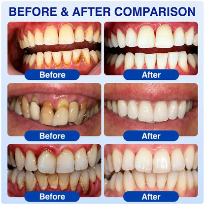 Rosviel® 🦷GumRevive Periodontal Care Gel🍀