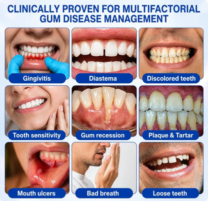 Rosviel® 🦷GumRevive Periodontal Care Gel🍀