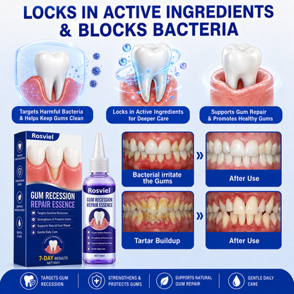 Rosviel® 🦷GumRevive Periodontal Care Gel🍀