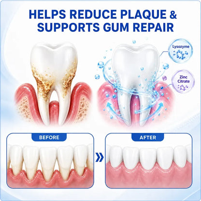 Rosviel® 🦷GumRevive Periodontal Care Gel🍀